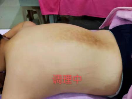 脊椎問題調(diào)理